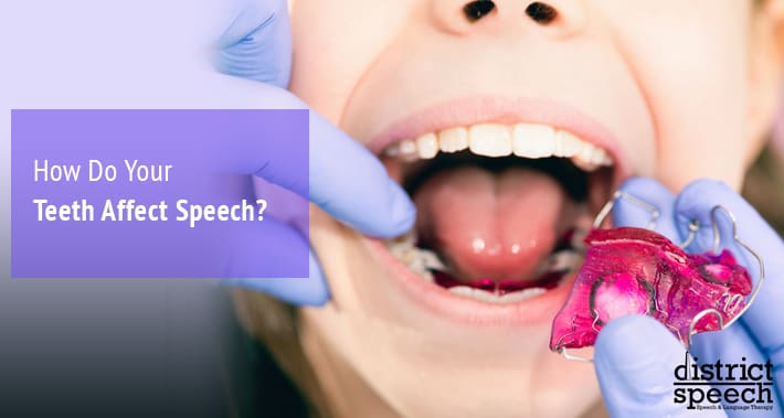 How Do Your Teeth Affect Speech? | District Speech & Language Therapy | Washington D.C. & Arlington VA